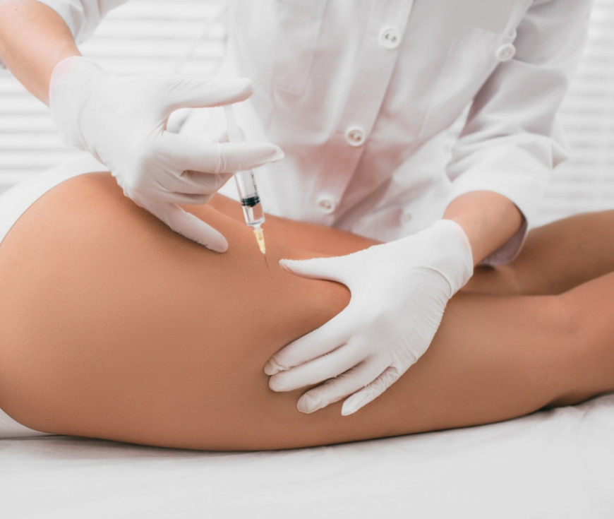 mesoterapia